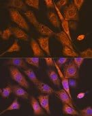 Anti-PEN2/PSENEN Antibody, clone 6J5O4, Rabbit Monoclonal
