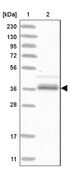 Anti-AKR1A1 antibody produced in rabbit Prestige Antibodies&#174; Powered by Atlas Antibodies, affinity isolated antibody, buffered aqueous glycerol solution