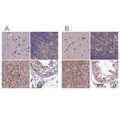 Anti-DNPEP antibody produced in rabbit Prestige Antibodies® Powered by Atlas Antibodies, affinity isolated antibody, buffered aqueous glycerol solution