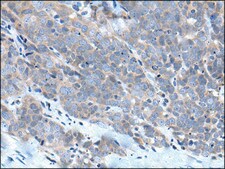 Anti-ZDHHC5 affinity isolated antibody