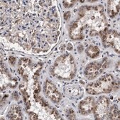抗-ACOX1 兔抗 Prestige Antibodies&#174; Powered by Atlas Antibodies, affinity isolated antibody, buffered aqueous glycerol solution, Ab1