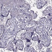 Anti-C5ORF49 antibody produced in rabbit Prestige Antibodies&#174; Powered by Atlas Antibodies, affinity isolated antibody, buffered aqueous glycerol solution