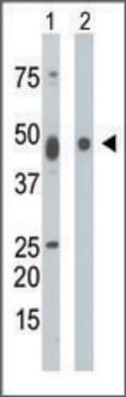 Anti-PIP5K2A (C-term) antibody produced in rabbit IgG fraction of antiserum, buffered aqueous solution