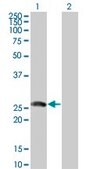 Monoclonal Anti-BTG4 antibody produced in mouse clone 1A6, purified immunoglobulin, buffered aqueous solution