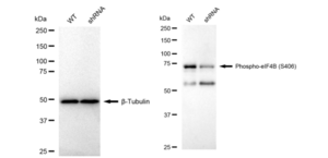 KD-Validated Anti-phospho-eIF4B (Ser406) Antibody, clone 23GB3905, Rabbit Monoclonal clone 23GB3905, recombinant rabbit monoclonal, expressed in HEK293 cells