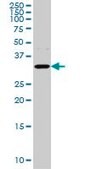 Monoclonal Anti-AQP8 antibody produced in mouse clone 1A1, purified immunoglobulin, buffered aqueous solution