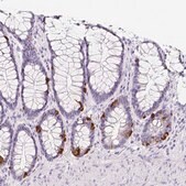 Anti-SLC18A1 antibody produced in rabbit Prestige Antibodies&#174; Powered by Atlas Antibodies, affinity isolated antibody