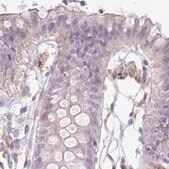 Anti-TMEM237 antibody produced in rabbit Prestige Antibodies&#174; Powered by Atlas Antibodies, affinity isolated antibody, buffered aqueous glycerol solution
