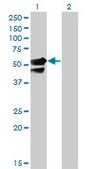Monoclonal Anti-AAK1 antibody produced in mouse clone 4B10, purified immunoglobulin, buffered aqueous solution