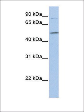 抗 FAM20C (AB2) 兔抗 affinity isolated antibody