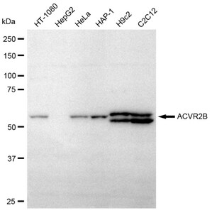 Anti ACVR2B Antibody, clone 23GB620, Rabbit Monoclonal clone 23GB620, recombinant rabbit monoclonal, expressed in HEK293 cells