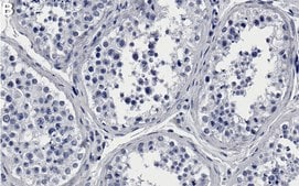 Anti-CBP Antibody, clone 3N20 ZooMAb&#174; Rabbit Monoclonal recombinant, expressed in HEK 293 cells