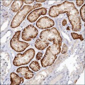 Anti-NOXA1 antibody produced in rabbit Prestige Antibodies&#174; Powered by Atlas Antibodies, affinity isolated antibody, buffered aqueous glycerol solution
