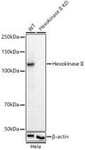 [KO Validated]Anti-Hexokinase II Antibody, clone 5N8G9, Rabbit Monoclonal