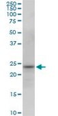 Monoclonal Anti-PGRMC2 antibody produced in mouse clone 2A3, purified immunoglobulin, buffered aqueous solution