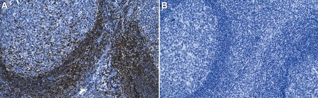 Anti-ZAP-70 Antibody, clone 1D9 ZooMAb&#174; Rabbit Monoclonal recombinant, expressed in HEK 293 cells