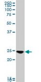 Monoclonal Anti-RAB33B antibody produced in mouse clone 6F4, purified immunoglobulin, buffered aqueous solution