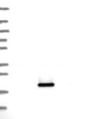 Anti-Hp Antibody Produced In Rabbit Prestige Antibodies&#174; Powered by Atlas Antibodies, affinity isolated antibody, buffered aqueous glycerol solution