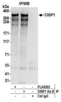 Goat anti-53BP1 Antibody, Affinity Purified Powered by Bethyl Laboratories, Inc.