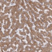Anti-MINPP1 antibody produced in rabbit Prestige Antibodies&#174; Powered by Atlas Antibodies, affinity isolated antibody, buffered aqueous glycerol solution