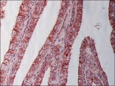 Monoclonal Anti-&#946;-Tubulin I antibody produced in mouse clone SAP.4G5, ascites fluid