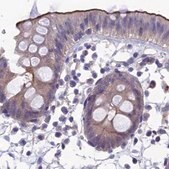 Anti-SNAP91 antibody produced in rabbit Prestige Antibodies&#174; Powered by Atlas Antibodies, affinity isolated antibody, buffered aqueous glycerol solution
