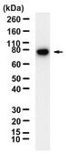 Anti-BTK Antibody, clone 1F5 ZooMAb® Rabbit Monoclonal recombinant, expressed in HEK 293 cells