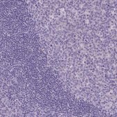 Anti-TTLL6 antibody produced in rabbit Prestige Antibodies&#174; Powered by Atlas Antibodies, affinity isolated antibody, buffered aqueous glycerol solution