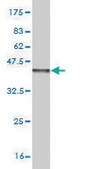 Monoclonal Anti-FGF1, (C-terminal) antibody produced in mouse clone 2E12, purified immunoglobulin, buffered aqueous solution