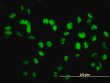 Monoclonal Anti-SIRT1 antibody produced in mouse clone 7B7, purified immunoglobulin, buffered aqueous solution