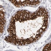Anti-KIAA1210 antibody produced in rabbit Prestige Antibodies&#174; Powered by Atlas Antibodies, affinity isolated antibody, buffered aqueous glycerol solution