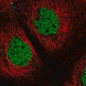 Anti-ZSCAN32 antibody produced in rabbit Prestige Antibodies® Powered by Atlas Antibodies, affinity isolated antibody, buffered aqueous glycerol solution