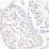 Anti-GLI1 antibody produced in rabbit