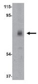 Anti-CAPN6 Antibody from rabbit, purified by affinity chromatography