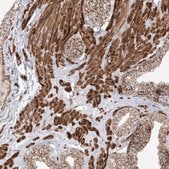 Anti-AARS2 antibody produced in rabbit Prestige Antibodies&#174; Powered by Atlas Antibodies, affinity isolated antibody, buffered aqueous glycerol solution