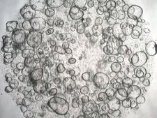 3dGRO Duodenum Intestinal Organoids, Age 59 (Prep ht-215-D) Normal, Duodenum, Age: 59, Female, Mutation: None