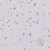 Anti-AKR1B1 antibody produced in rabbit Prestige Antibodies&#174; Powered by Atlas Antibodies, affinity isolated antibody