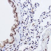 Anti-MED4 Antibody, clone 8T5C9, Rabbit Monoclonal
