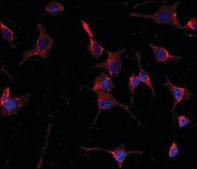 Anti-CYP26A1 (center) antibody produced in rabbit saturated ammonium sulfate (SAS) precipitated, buffered aqueous solution