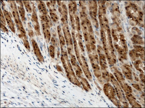 Anti-Destrin/ADF (GV-13) antibody produced in rabbit affinity isolated antibody, buffered aqueous solution