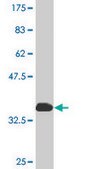 Monoclonal Anti-CRSP7 antibody produced in mouse clone 2G10, purified immunoglobulin, buffered aqueous solution