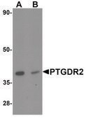 Anti-PTGDR2 antibody produced in rabbit affinity isolated antibody