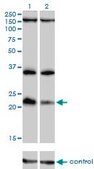 Monoclonal Anti-DUSP22 antibody produced in mouse clone 3D3, purified immunoglobulin, buffered aqueous solution