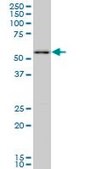 Monoclonal Anti-PRPF19 antibody produced in mouse clone 2E5, purified immunoglobulin, buffered aqueous solution