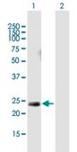 Anti-HRAS antibody produced in mouse purified immunoglobulin, buffered aqueous solution