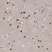 Anti-MCM9 antibody produced in rabbit Prestige Antibodies&#174; Powered by Atlas Antibodies, affinity isolated antibody, buffered aqueous glycerol solution