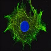 Anti-Nestin (C-terminal region) antibody produced in rabbit ~1.5&#160;mg/mL, affinity isolated antibody