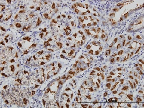 Monoclonal Anti-WWP1 antibody produced in mouse clone 1A7, purified immunoglobulin, buffered aqueous solution