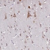 Anti-WDR35 antibody produced in rabbit affinity isolated antibody, buffered aqueous glycerol solution