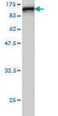 ANTI-RDX antibody produced in mouse clone 2E7, purified immunoglobulin, buffered aqueous solution